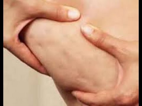 خلطات طبيعية لشد ترهلات الجسم