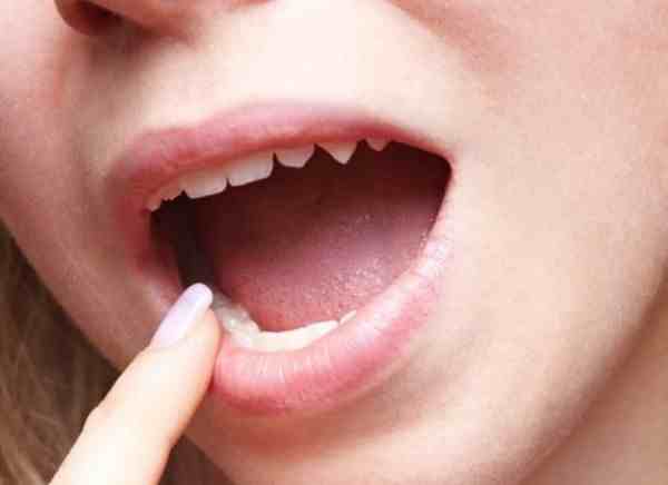 لون لسانك قد يدل على إصابتك بالأمراض