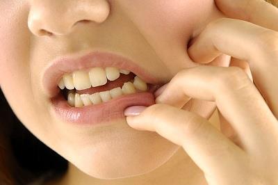 7 أطعمة و مشروبات تترك بقع على أسنانك