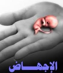 الإجهاض - اسبابه - وعلاجه