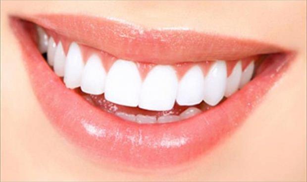 احصلي على ابتسامة ناصعة البياض طبيعيًا