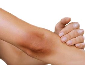 ماسكات لتفتيح الكوعين والركبتين