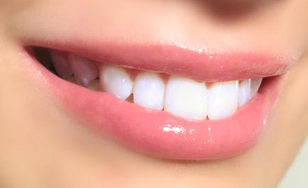 كوني كالنجمات ب 5 طرق لتبيض الأسنان