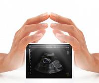 أسباب الإجهاض وتجنب حدوثه!