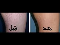  ملف مجمع عن الخطوط البيضاء والحمراء والحلول طبيعيه وطبيه ؟	