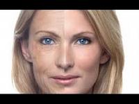 طرق التخلص من تجاعيد الوجه والبثور السوداء