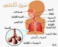 علاج سحري لضيق التنفس