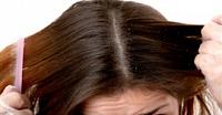 5 وصفات طبيعية لعلاج قشرة الشعر وحكة الرأس