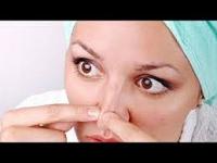 كيفيه ازاله البقع السوداء بطرق بسيطه