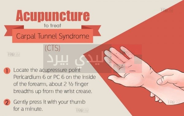 Acupuncture-carpal2-600x450