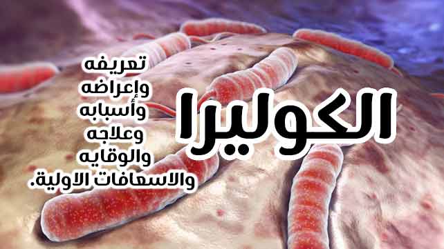 علاج وأعراض والوقاية من الكوليرا